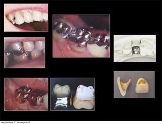 segunda-feira, 11 de março de 13
 