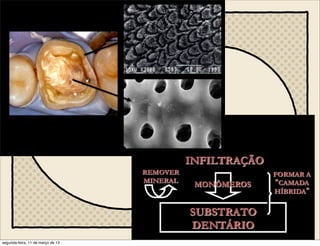 Cimentação Adesão
“dente”
hibridização
segunda-feira, 11 de março de 13
 