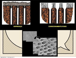 Cimentação Adesão
“dente”
hibridização
segunda-feira, 11 de março de 13
 