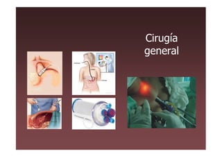 Cirugía
general
 