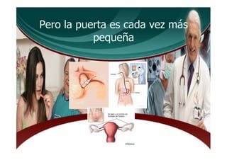 Pero la puerta es cada vez más
           pequeña
 