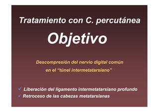 Tratamiento con C. percutánea

           Objetivo
      Descompresión del nervio digital común
          en el “túnel intermetatarsiano”



 Liberación del ligamento intermetatarsiano profundo
 Retroceso de las cabezas metatarsianas
 