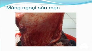 đặc điểm thai nhi và phần phụ đủ tháng