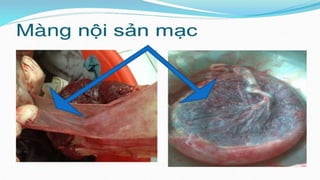 đặc điểm thai nhi và phần phụ đủ tháng