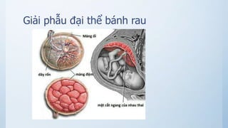 Giải phẫu đại thể bánh rau
 