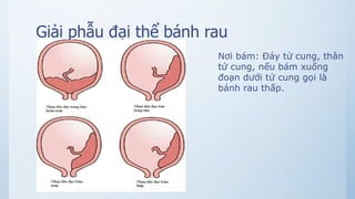 Giải phẫu đại thể bánh rau
Nơi bám: Đáy tử cung, thân
tử cung, nếu bám xuống
đoạn dưới tử cung gọi là
bánh rau thấp.
 