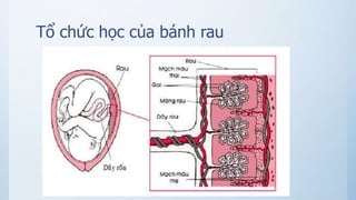 Tổ chức học của bánh rau
 