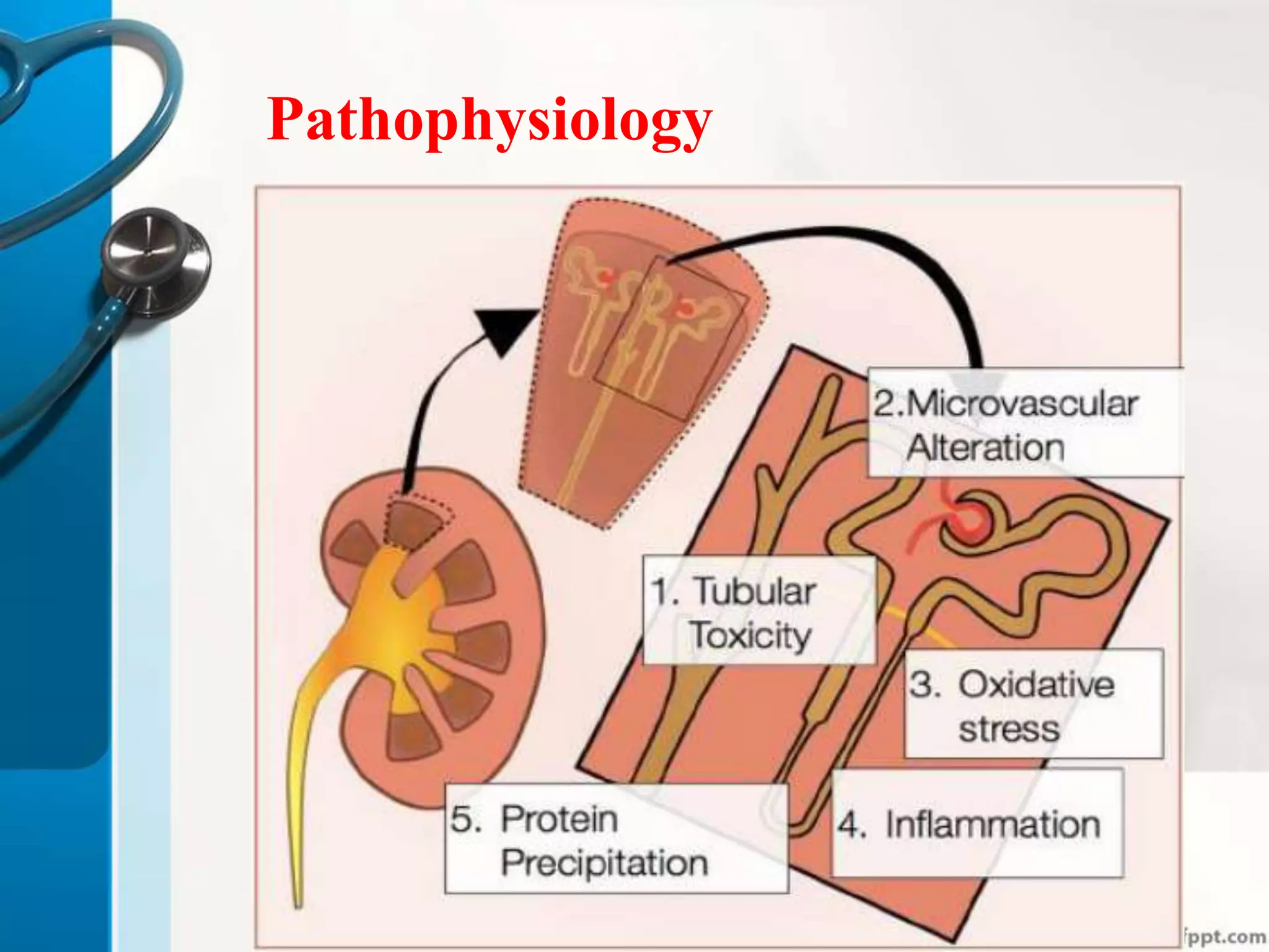 Pathophysiology
 