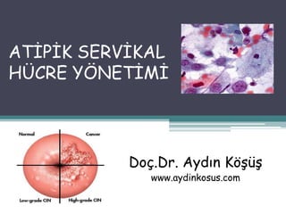 ATİPİK SERVİKAL
HÜCRE YÖNETİMİ
Doç.Dr. Aydın Köşüş
www.aydinkosus.com
 