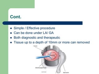 Cont.
 Simple / Effective procedure
 Can be done under LA/ GA
 Both diagnostic and therapeutic
 Tissue up to a depth of 10mm or more can removed
 