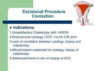 Excisional Procedure
Conization
 Indications
1.Unsatisfactory Colposcopy with HGCIN
2.Endocervical cytology / ECC +ve for CIN 2or3
3.Lack of correlation between cytology, biopsy and
colposcopy
4.Microinvasion suspected on cytology, biopsy or
colposcopy
5.Adenocarcinoma in situ on biopsy or ECC
 