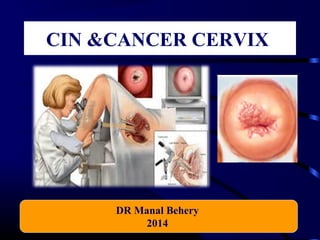 CIN &CANCER CERVIX 
DR Manal Behery 
2014 
 