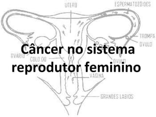 Câncer no sistema
reprodutor feminino
 