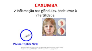 CAXUMBA
Disponível em: https://saude.gov.br/saude-de-a-z/poliomielite, https://www.freepik.com/free-vector/,
https://www.wafb.com/2020/02/05/lsu-confirms-five-students-have-mumps/, google.com
✔ Inflamação nas glândulas, pode levar à
infertilidade.
Vacina Tríplice Viral
 