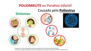 POLIOMIELITE ou Paralisia Infantil
Disponível em: https://saude.gov.br/saude-de-a-z/poliomielite, https://www.freepik.com/free-
vector/,https://www.labnetwork.com.br/noticias/laboratorios-participam-do-plano-de-erradicacao-do-poliovirus/
Causada pelo Poliovírus
Sintomas
 