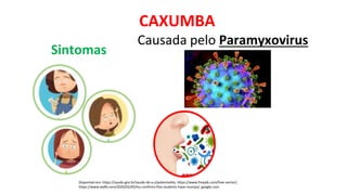 CAXUMBA
Disponível em: https://saude.gov.br/saude-de-a-z/poliomielite, https://www.freepik.com/free-vector/,
https://www.wafb.com/2020/02/05/lsu-confirms-five-students-have-mumps/, google.com
Causada pelo Paramyxovirus
Sintomas
 