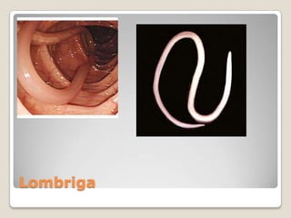 Lombriga
 