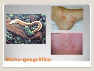 Bicho-geográfico
 