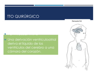 TTO QUIRÚRGICO 
 VENTRICULOATRIAL 
 Una derivación ventriculoatrial 
deriva el líquido de los 
ventrículos del cerebro a una 
cámara del corazón. 
 