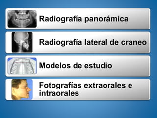 Radiografía panorámica
Radiografía lateral de craneo
Modelos de estudio
Fotografías extraorales e
intraorales
 