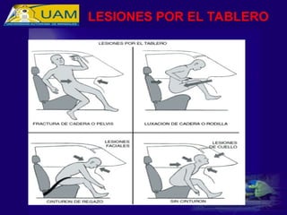 LESIONES POR EL TABLERO
 