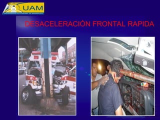 DESACELERACIÓN FRONTAL RAPIDA
 