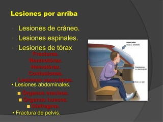 Lesiones por arriba
• Lesiones de cráneo.
• Lesiones espinales.
• Lesiones de tórax.
Fracturas.
Neumotórax.
Hemotórax.
Contusiones.
Lesiones vasculares.
• Lesiones abdominales.
• Fractura de pelvis.
Órganos macizos.
Órganos huecos.
Diafragma.
 