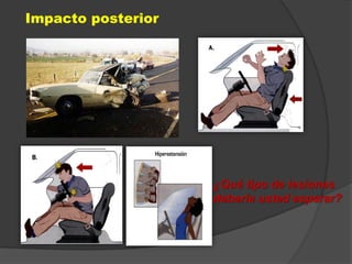 Impacto posterior
¿Qué tipo de lesiones
debería usted esperar?
 