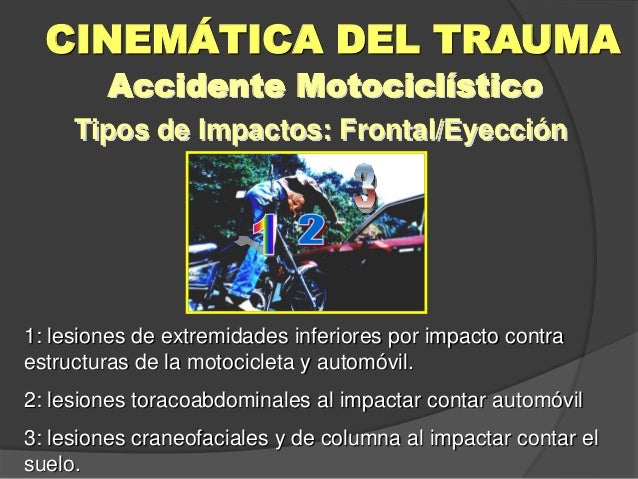 Cinematica del trauma