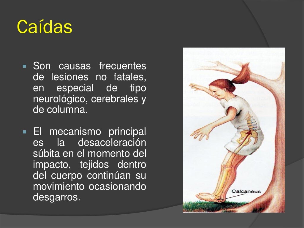 Cinematica del trauma