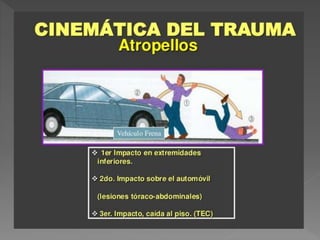 Cinematica del trauma | PPTX