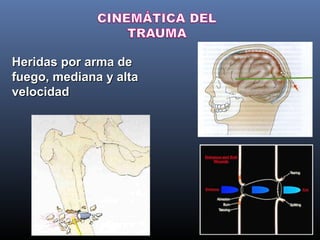 Cinematica del trauma | PPT