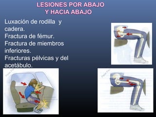 Cinematica del trauma | PPT