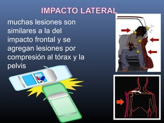 Cinematica del trauma | PPT