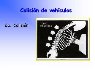 2a. Colisión
Colisión de vehículos
Programa Nacional de Capacitación en Urgencia
 