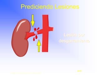Lesión por
desgarramiento
Prediciendo Lesiones
Copyright © 2003, Elsevier Science (USA). All rights reserved.
2-12
 