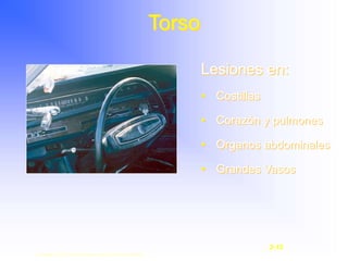Torso
Lesiones en:
• Costillas
• Corazón y pulmones
• Organos abdominales
• Grandes Vasos
Copyright © 2003, Elsevier Science (USA). All rights reserved.
2-15
 