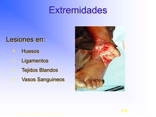 Extremidades
Lesiones en:
• Huesos
• Ligamentos
• Tejidos Blandos
• Vasos Sanguineos
Copyright © 2003, Elsevier Science (USA). All rights reserved.
2-16
 