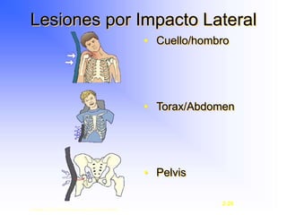 Lesiones por Impacto Lateral
• Cuello/hombro
• Torax/Abdomen
• Pelvis
Copyright © 2003, Elsevier Science (USA). All rights reserved.
2-26
 