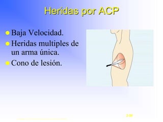  Baja Velocidad.
 Heridas multiples de
un arma única.
 Cono de lesión.
Heridas por ACP
Copyright © 2003, Elsevier Science (USA). All rights reserved.
2-50
 