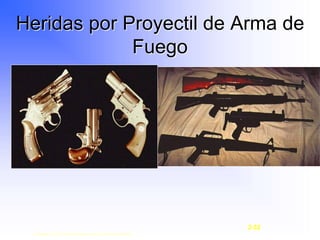 Heridas por Proyectil de Arma de
Fuego
Copyright © 2003, Elsevier Science (USA). All rights reserved.
2-52
 