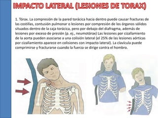 1. Tórax. La compresión de la pared torácica hacia dentro puede causar fracturas de
las costillas, contusión pulmonar o lesiones por compresión de los órganos sólidos
situados dentro de la caja torácica, pero por debajo del diafragma, además de
lesiones por exceso de presión (p. ej., neumotórax) Las lesiones por cizallamiento
de la aorta pueden asociarse a una colisión lateral (el 25% de las lesiones aórticas
por cizallamiento aparece en colisiones con impacto lateral). La clavícula puede
comprimirse y fracturarse cuando la fuerza se dirige contra el hombro.
 
