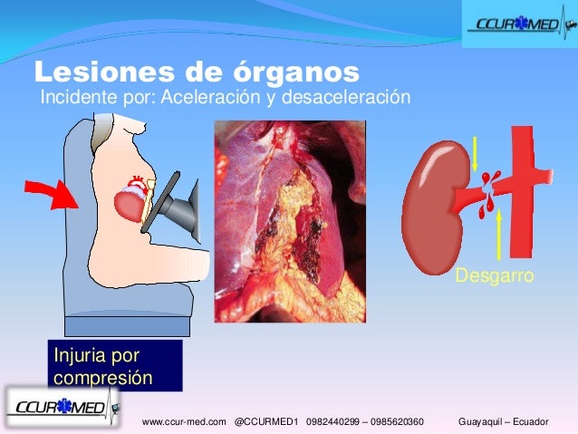 Cinematica del trauma CCUR-MED