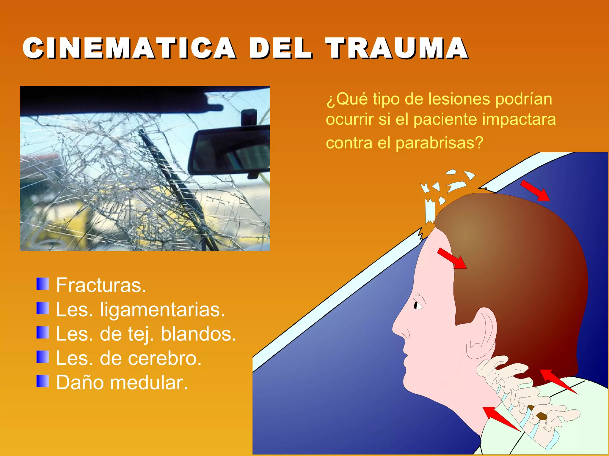 Cinematica del Trauma | PPT