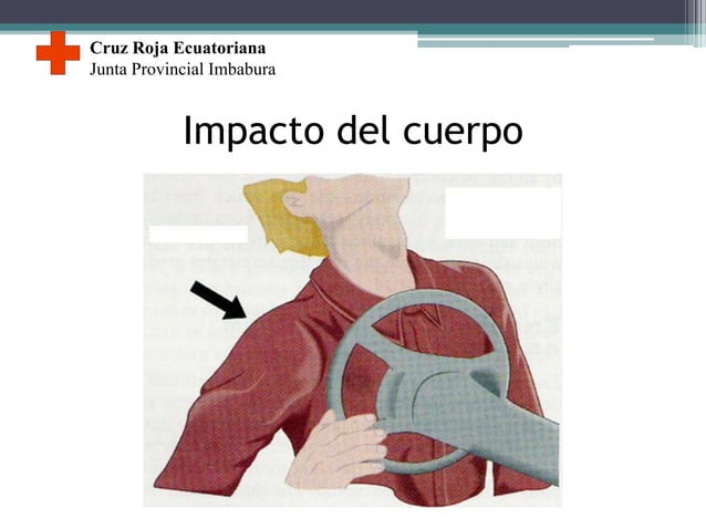 Cinematica del trauma en accidentes vehiculares | PPTX