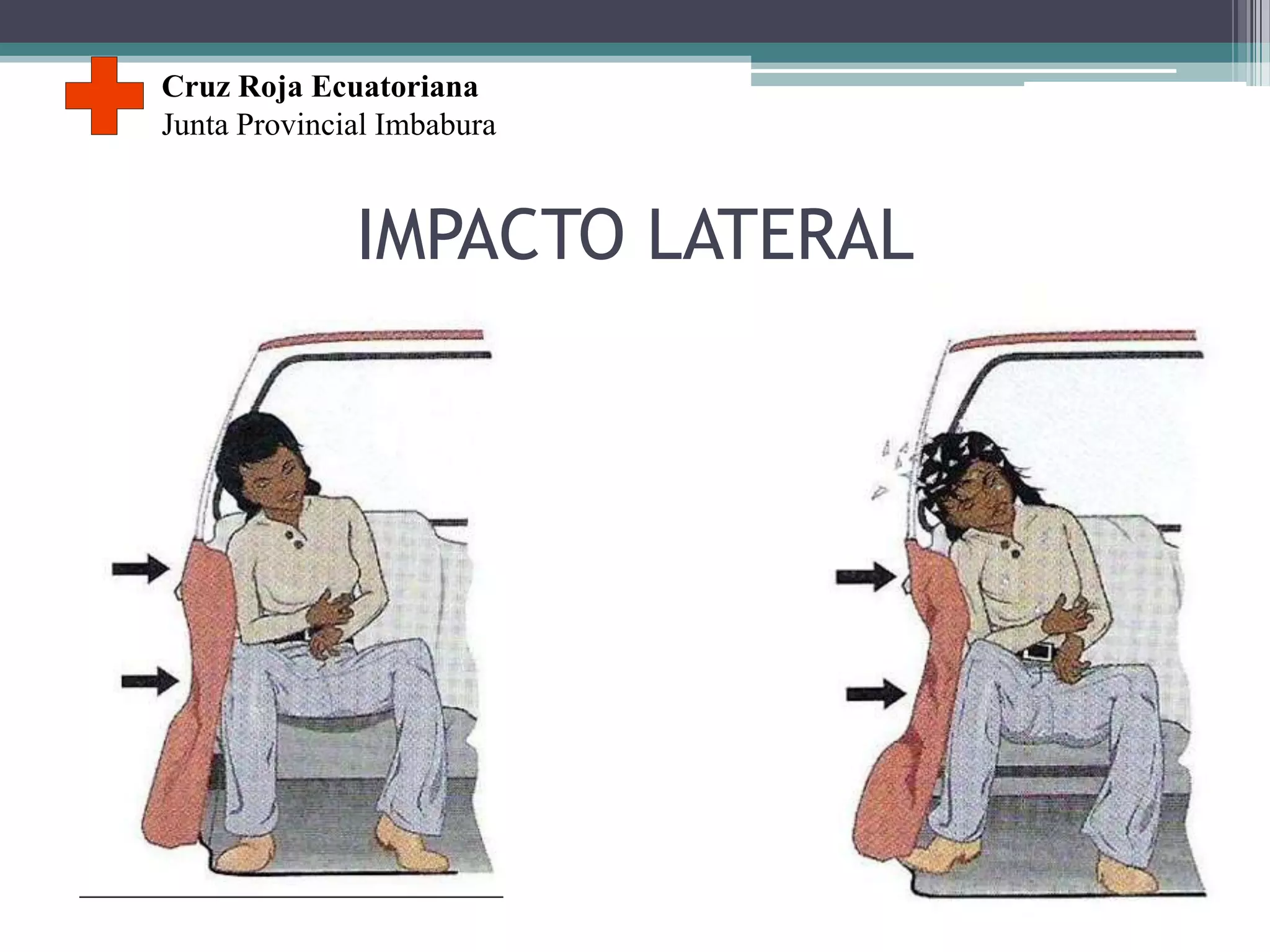 Cinematica del trauma en accidentes vehiculares | PPTX | First Aid ...