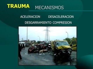 TRAUMA     MECANISMOS
   ACELERACION   DESACELERACION
     DESGARRAMIENTO COMPRESION
 