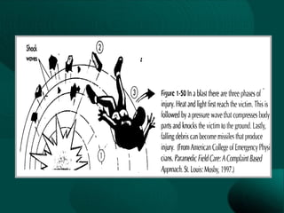 Cinematica del trauma en urgencias