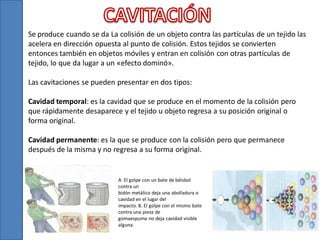 Se produce cuando se da La colisión de un objeto contra las partículas de un tejido las
acelera en dirección opuesta al punto de colisión. Estos tejidos se convierten
entonces también en objetos móviles y entran en colisión con otras partículas de
tejido, lo que da lugar a un «efecto dominó».
Las cavitaciones se pueden presentar en dos tipos:

Cavidad temporal: es la cavidad que se produce en el momento de la colisión pero
que rápidamente desaparece y el tejido u objeto regresa a su posición original o
forma original.
Cavidad permanente: es la que se produce con la colisión pero que permanece
después de la misma y no regresa a su forma original.

A. El golpe con un bate de béisbol
contra un
bidón metálico deja una abolladura o
cavidad en el lugar del
impacto. B. El golpe con el mismo bate
contra una pieza de
gomaespuma no deja cavidad visible
alguna.

 