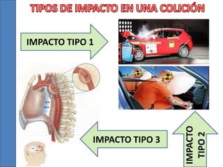 IMPACTO TIPO 3

IMPACTO
TIPO 2

IMPACTO TIPO 1

 